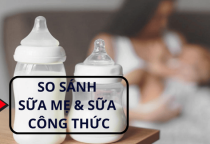 So sánh giữa sữa mẹ và sữa công thức – Khi nào nên bổ sung?